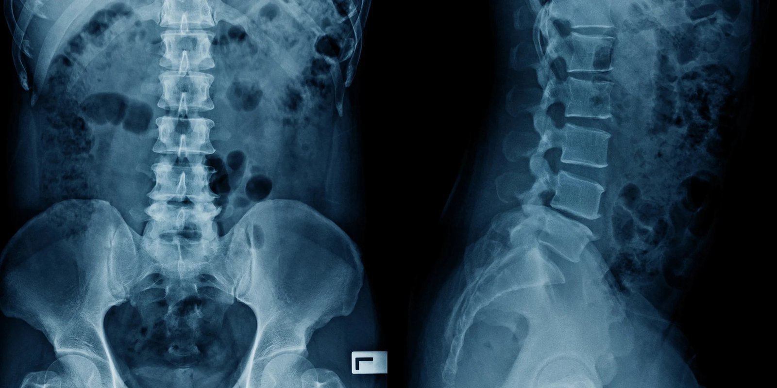 Procedimientos de neurocirugía